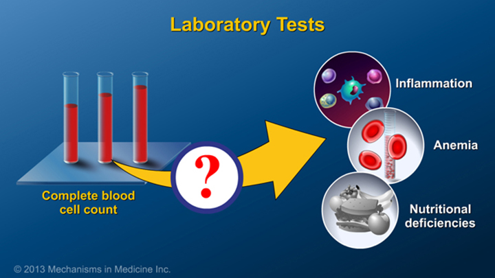 Laboratory Tests