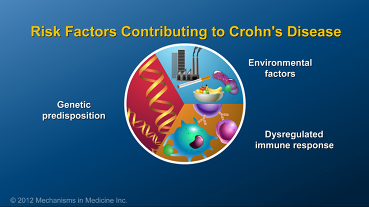 Risk Factors and Crohn’s