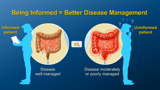 Understanding the Risks and Benefits of IBD Therapies