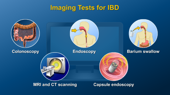 Animation - Diagnosing IBD