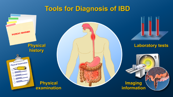 Slide Show - Diagnosing IBD