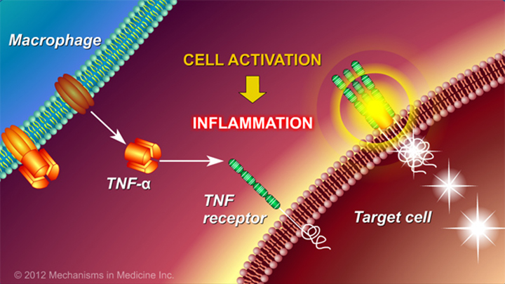 Slide Show - Chronic Inflammation in IBD and How Anti-TNF Therapy Works