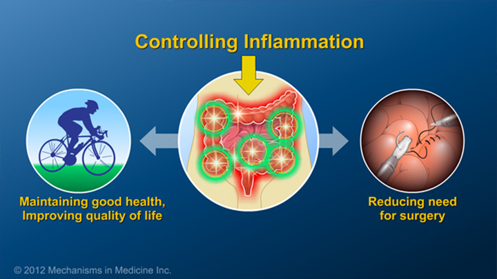 Control inflammation and IBD