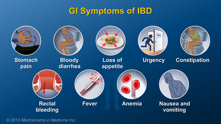 GI Symptoms of IBD