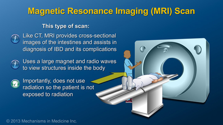 Magnetic Resonanse Imaging (MRI) Scan