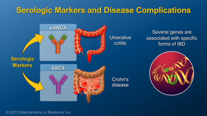 Serologic Markers and Disease Complications