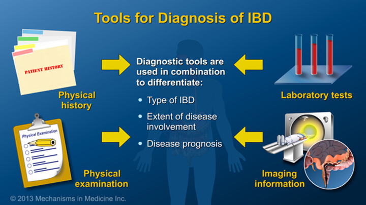 Tools for Diagnosis of IBD