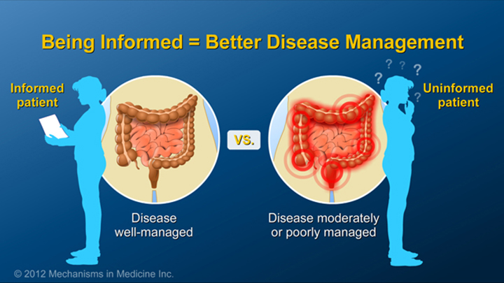 Informed Patients and IBD