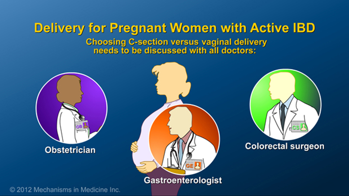 Delivery for Pregnancy Women with IBD