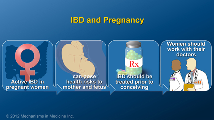 IBD and Pregnancy