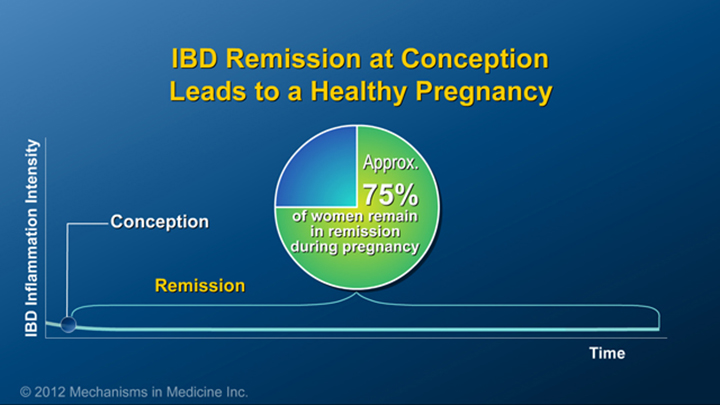 IBD Remission at Conception