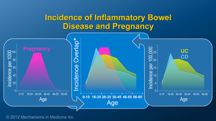 Incidence of IBD and Pregnancy