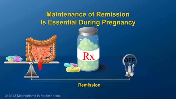 Maintenance of Remission and IBD