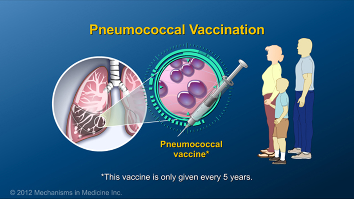 Pneumococcal Vaccine and IBD