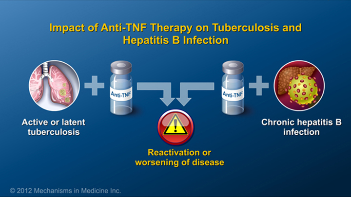 TB and Hepatitis with IBD Therapy