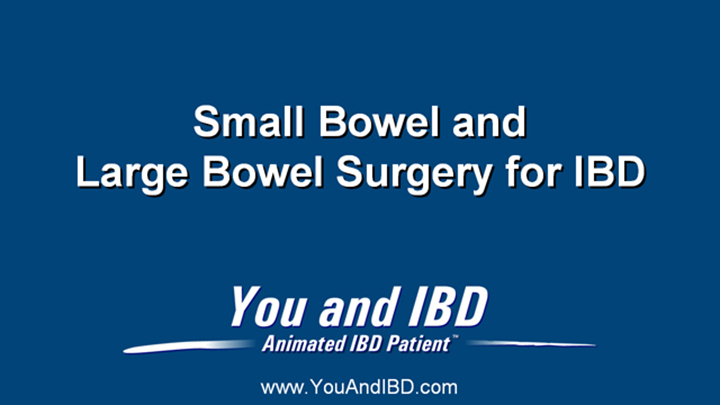 Small and Large Bowel Surgery for IBD