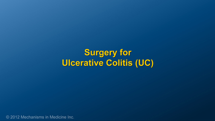 Surgery for Ulcerative Colitis