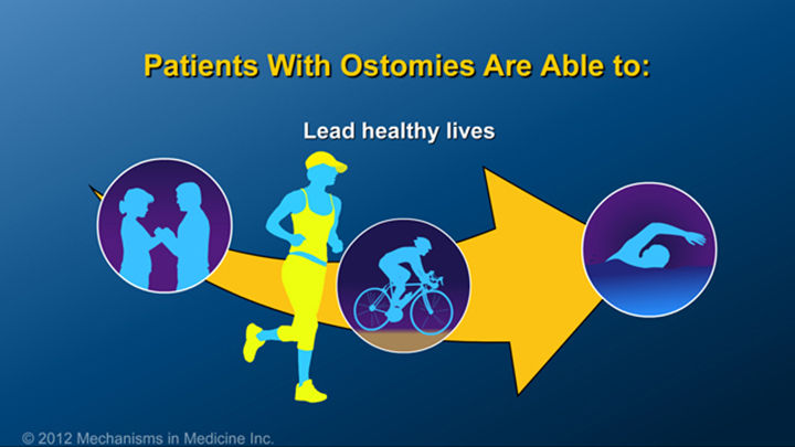 IBD Patients with Ostomies