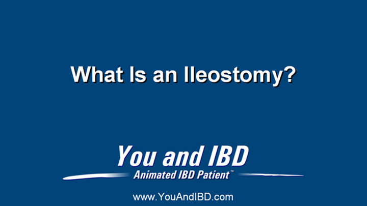 What is an Ileostomy for IBD