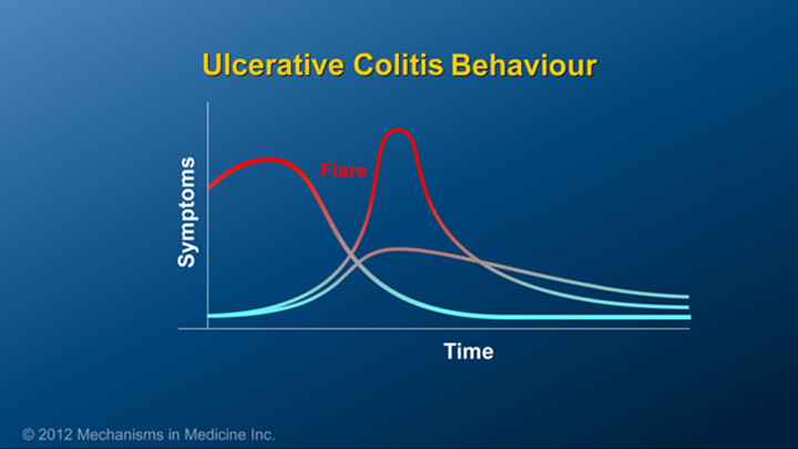 Ulcerative Colitis Behaviour